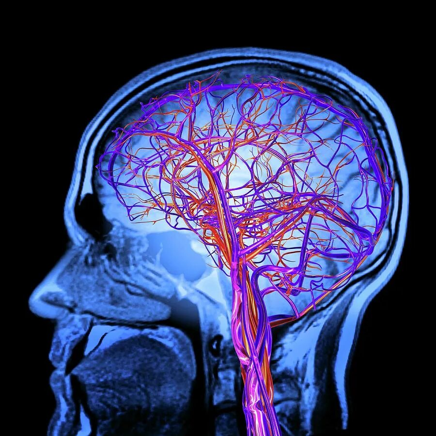 Нервные сосуды головного мозга. Магнитно-резонансная ангиография сосудов головного мозга. Мрт ангиограмма сосудов головного мозга. Мрт ангиография артерий головного мозга. Кт ангиография сосудов головного мозга.