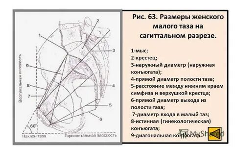 Сагиттальный размер