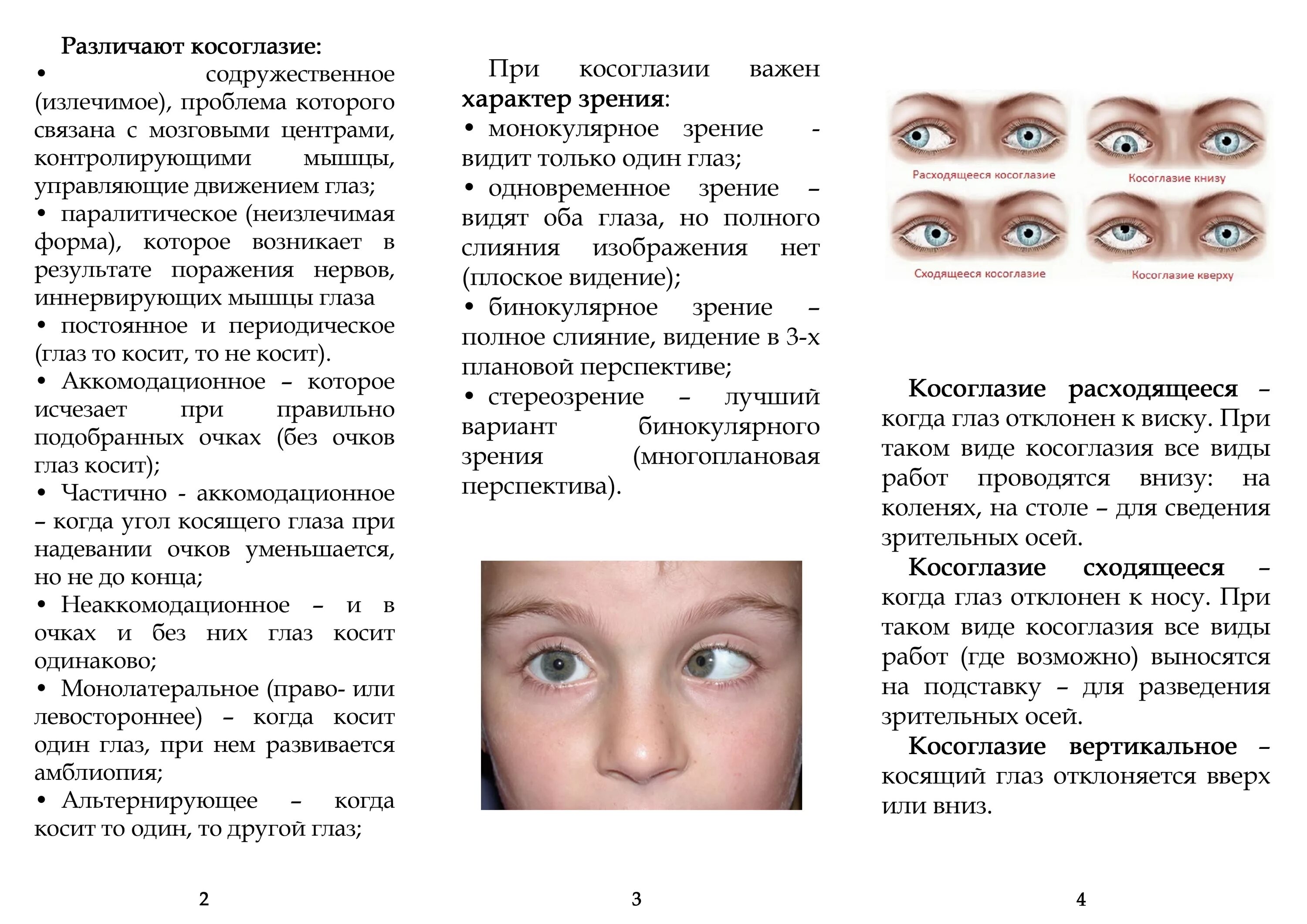 Косит глаз причины. Гимнастика для глаз для исправления косоглазия. Гимнастика для глаз при расходящемся косоглазии. Косоглазие упражнения для глаз. Гимнастика для глаз при сходящемся косоглазии у детей.