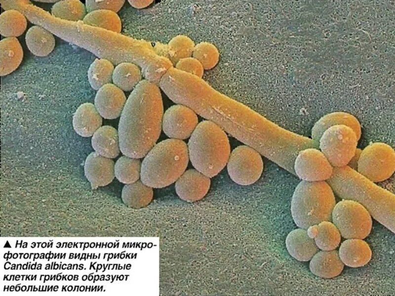 Дрожжеподобный гриб Candida albicans. Candida albicans под микроскопом. Грибок кандида под микро.