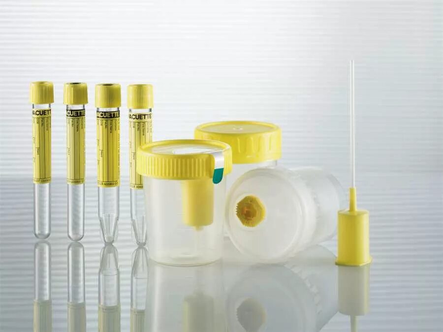 Забор мочи. Забор мочи. Держатель). Правила забора мочи. Исследование мочи в лаборатории.