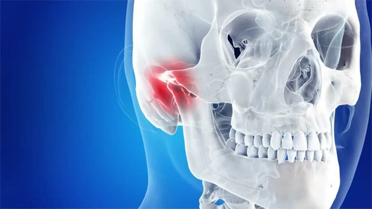 Из за чего может болеть челюсть. Гнатология ВНЧС.