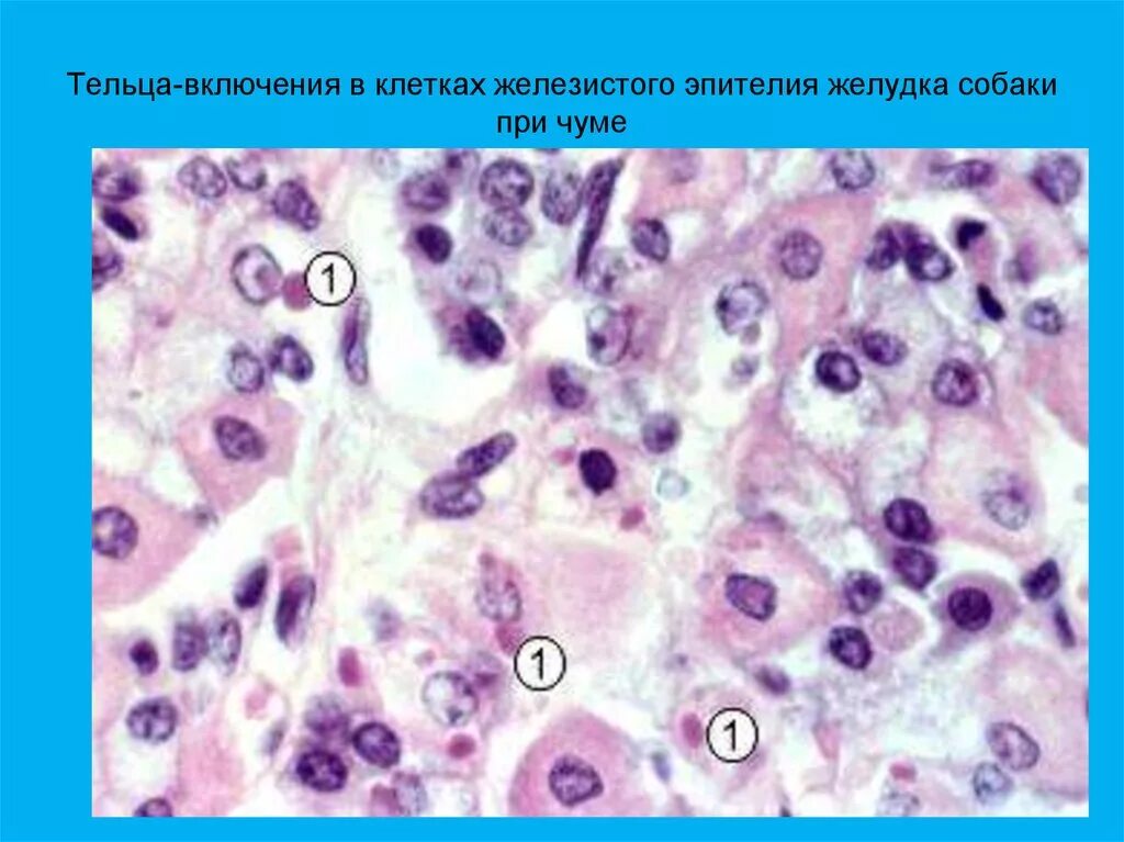 Синдром тельца. Тельца Коудри патанатомия. Тельца включения при чуме плотоядных. Внутриклеточные тельца-включения.