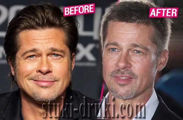 Брэд Питт ринопластика. Брэд Питт пластика. Брэд Питт после пластики. Brad Pitt после пластики. Брэд питт пластика 2024