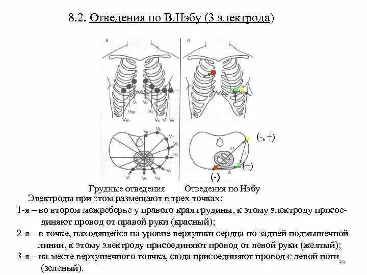 Грудные отведения на ЭКГ электроды. Отведения в7-в9. 6 Грудных отведений ЭКГ. ЭКГ грудные отведения точки. Правые грудные отведения