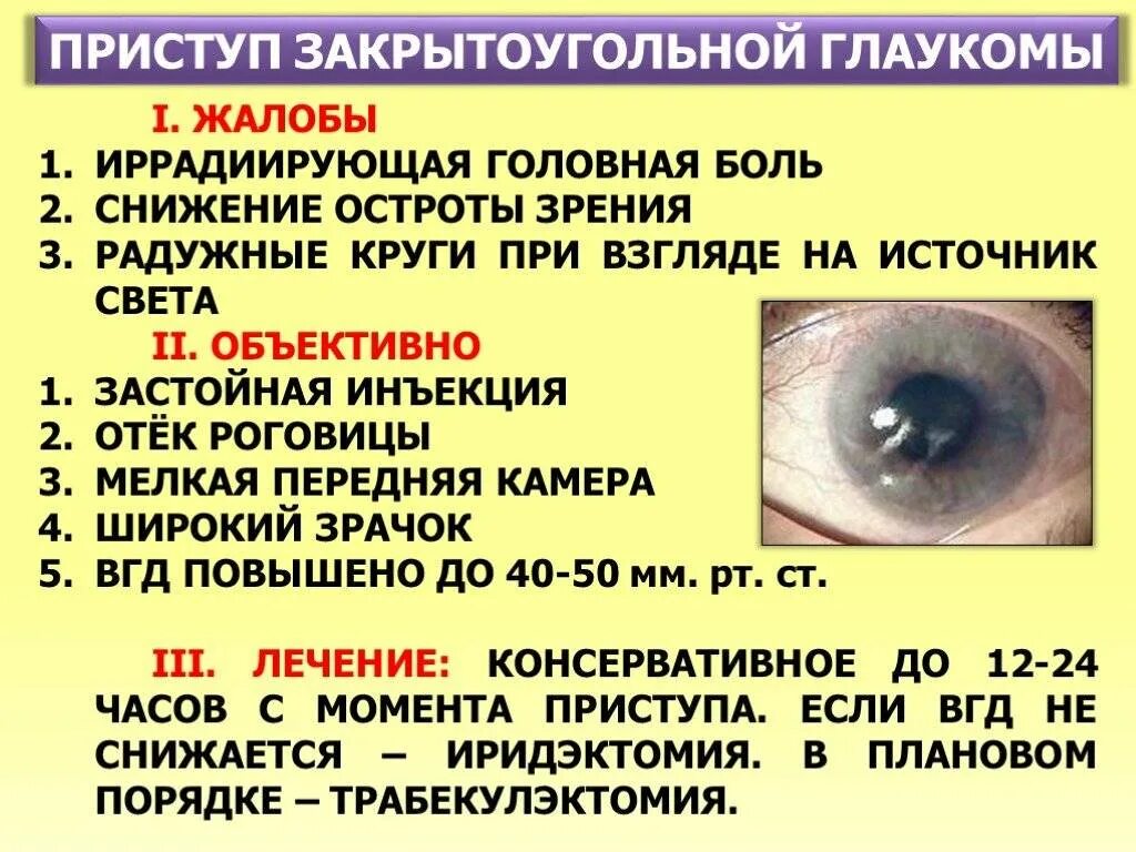 Что делать при глаукоме глаза. Приступ открытоугольной глаукомы симптомы. Симптомы острого приступа закрытоугольной глаукомы. Острый приступ открытоугольной глаукомы. Закрытоугольная глаукома глаза.