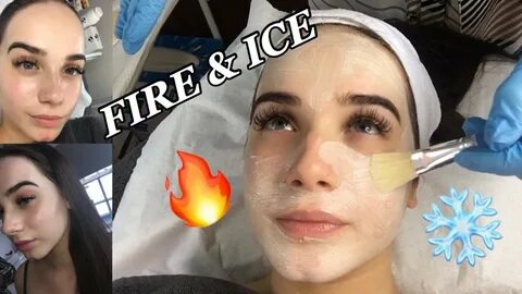 Ice peeling