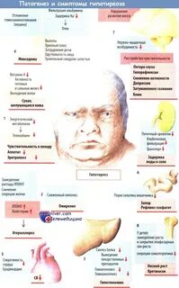 Гипотиреоз ноги
