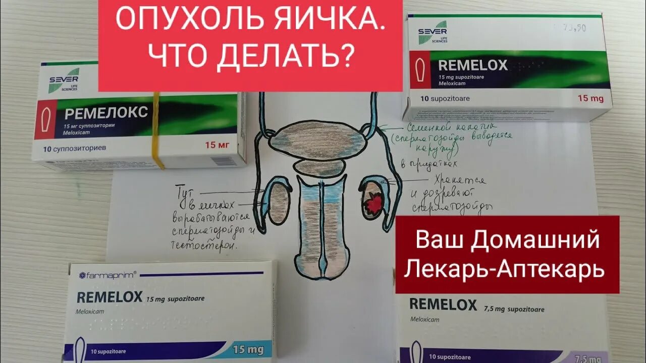 Опухли яйца у мужчины причины. Таблетки от кисты яичка. Очень опухшие яички у мужчины.