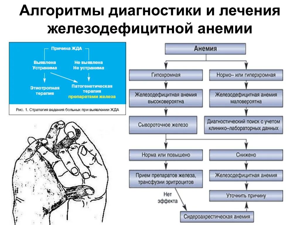 Алгоритм лечения железодефицитной анемии. Алгоритм лечения детей с железодефицитной анемией. Схема диагностика железодефицитной анемии. Инструментальные методы исследования при железодефицитной анемии. Методы лечения анемии