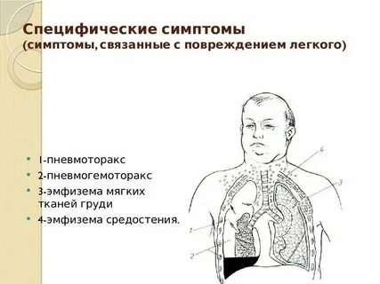 Эмфизема шеи