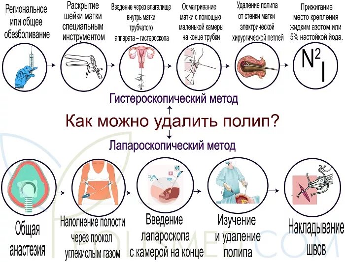 Что произойдет если удалить матку