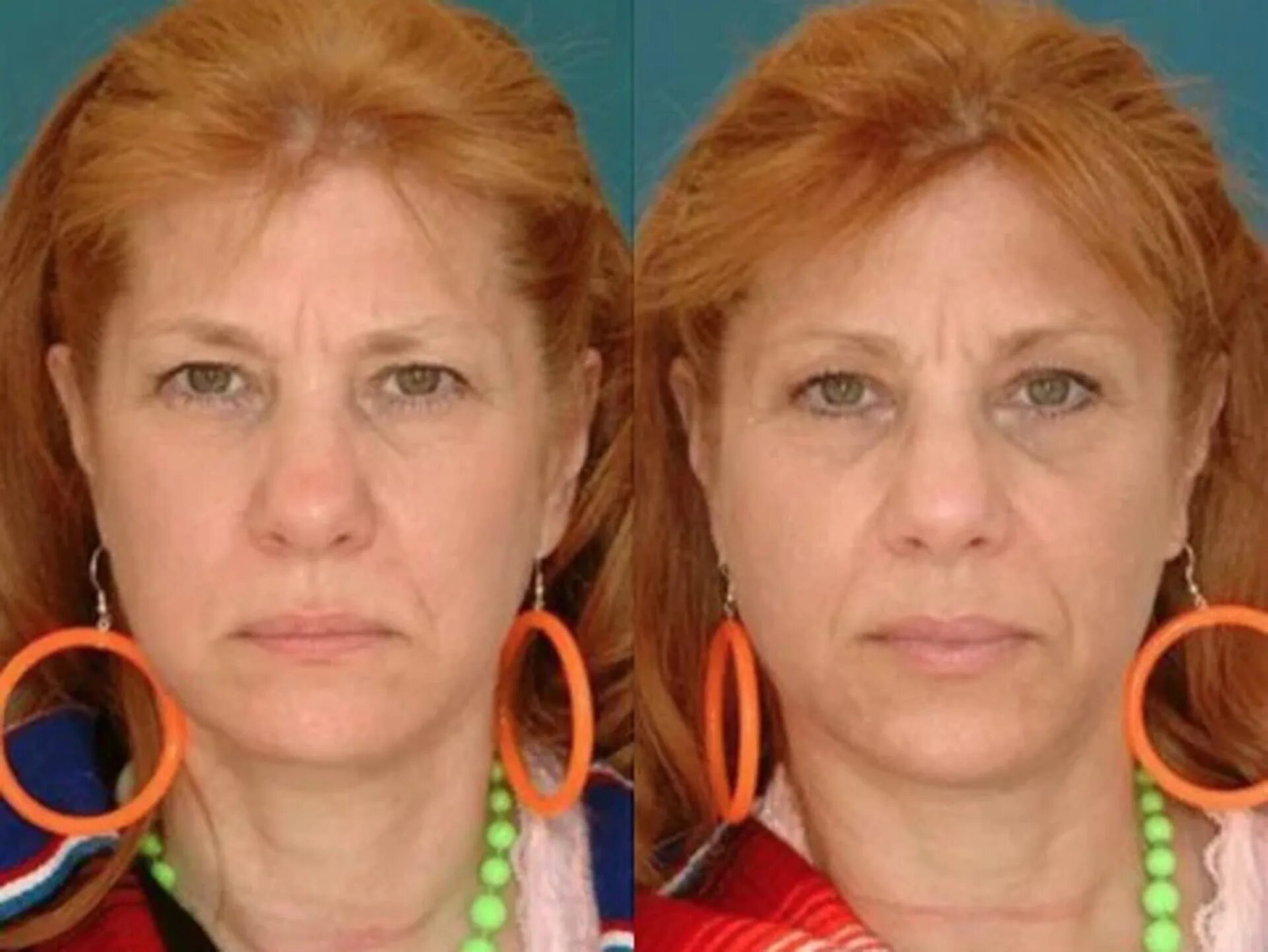 курящий человек до и после