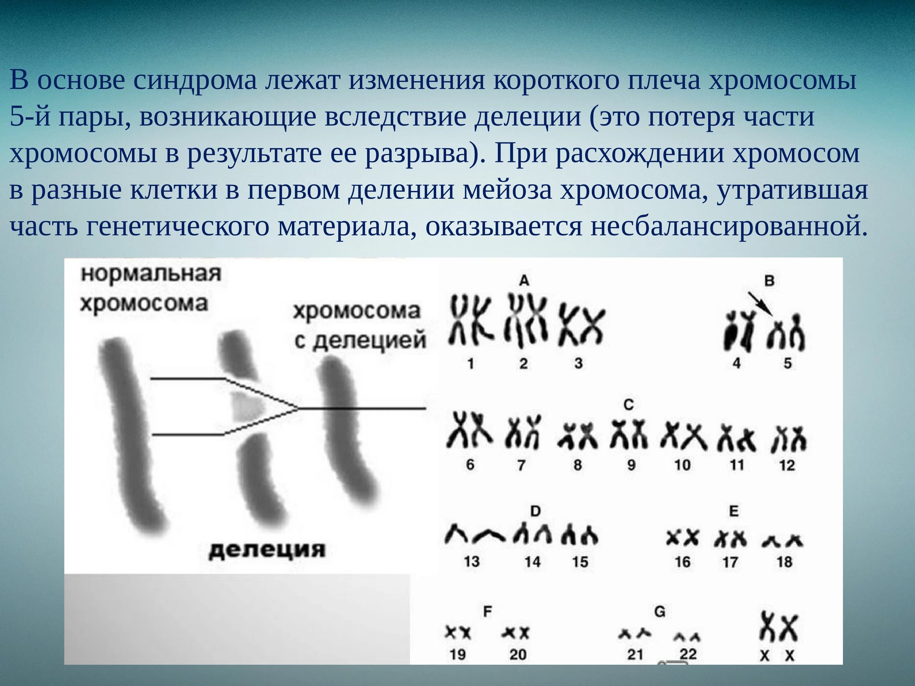 Сколько хромосом в зрелом эритроците. Синдром кошачьего крика (делеция в 5-Ой хромосоме);. Кариотип синдрома кошачьего крика формула. Синдром кошачьего крика наследование. Кариотип свойственный синдрому кошачьего крика.