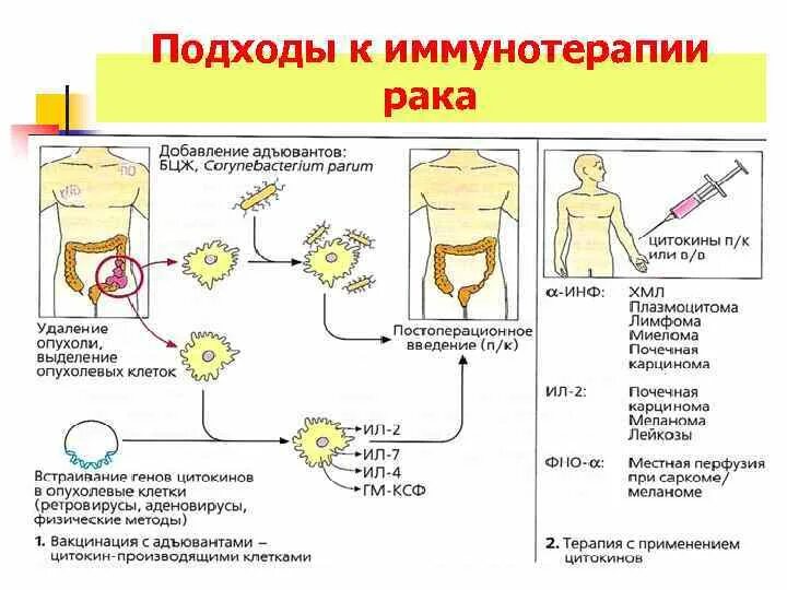 Химиотерапия иммунитет. Противоопухолевый иммунитет иммунология схема. Иммунная терапия в онкологии. Подходы к химиотерапии и иммунотерапии опухолей. Иммунотерапия онкологических заболеваний.