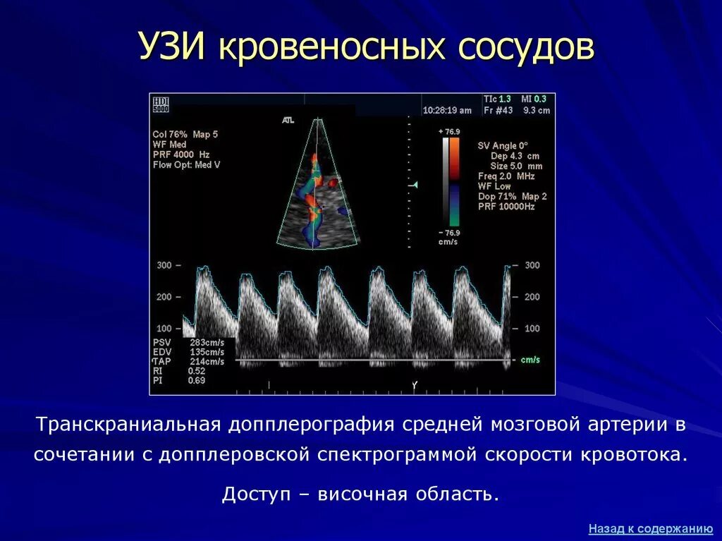 Сосуды головного мозга норма