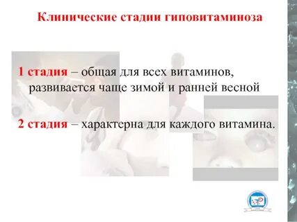 Общая стадия это