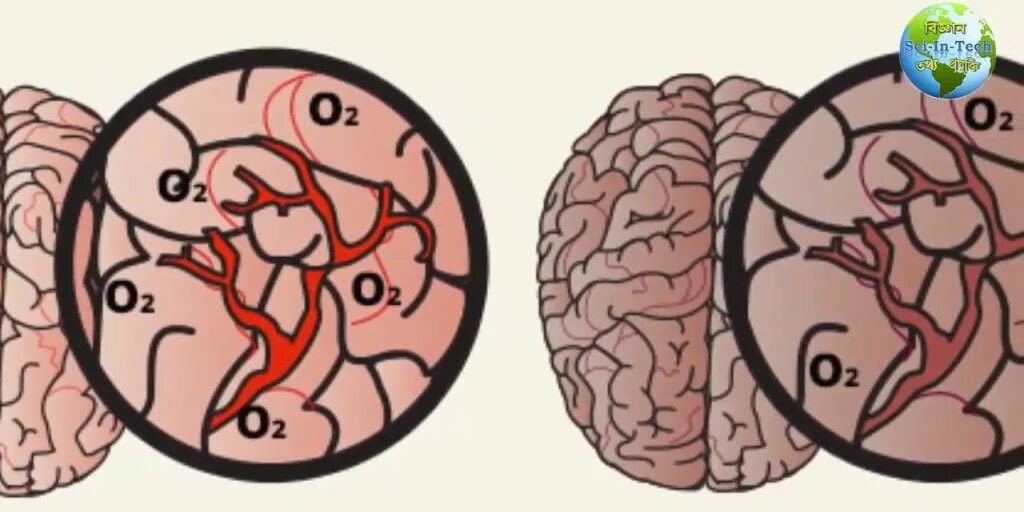 Топоксия. Дыхательная гипоксия проявления. Аноксическая гипоксия. Не хватает кислорода в головном мозге. Гипоксия симптомы у взрослых.