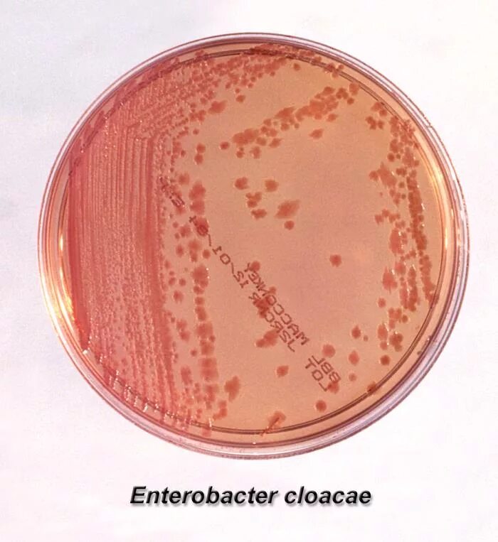 Cloacae энтеробактерии. ЦИТРОБАКТЕР Диверсус. Энтеробактер клоаке на средах Эндо. Enterobacter aerogenes Эндо. Enterobacter cloacae что это