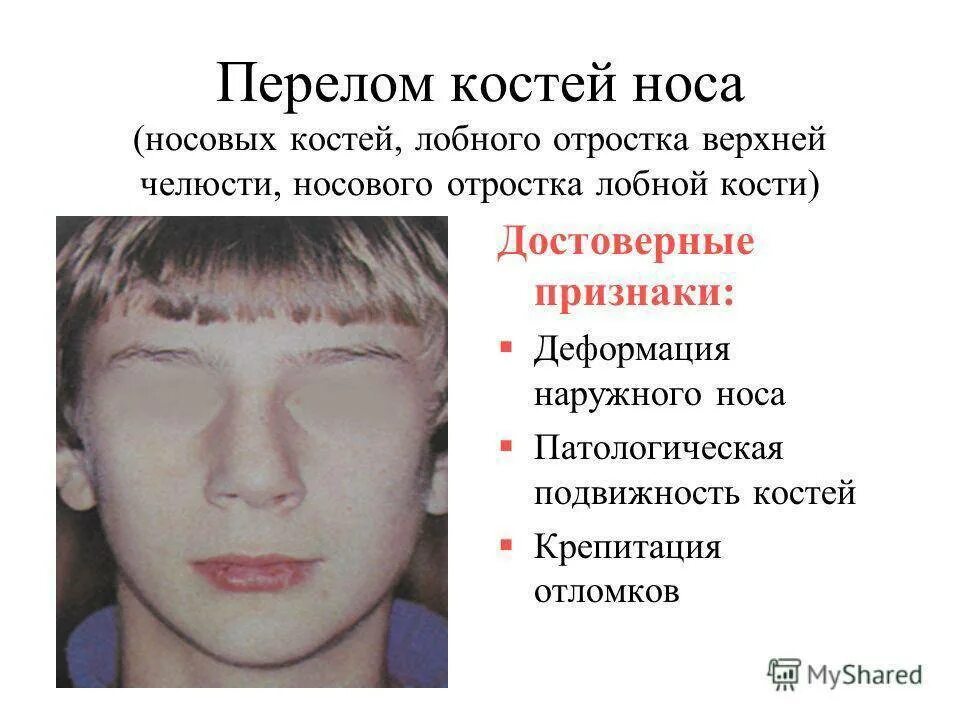 Как определить сломанное