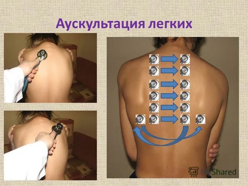 методика обследования дыхательной системы у детей. точки сравнительной аускультации легких. аускультация легких спереди. методы обследования органов дыхания у детей. аускультация легких у детей.