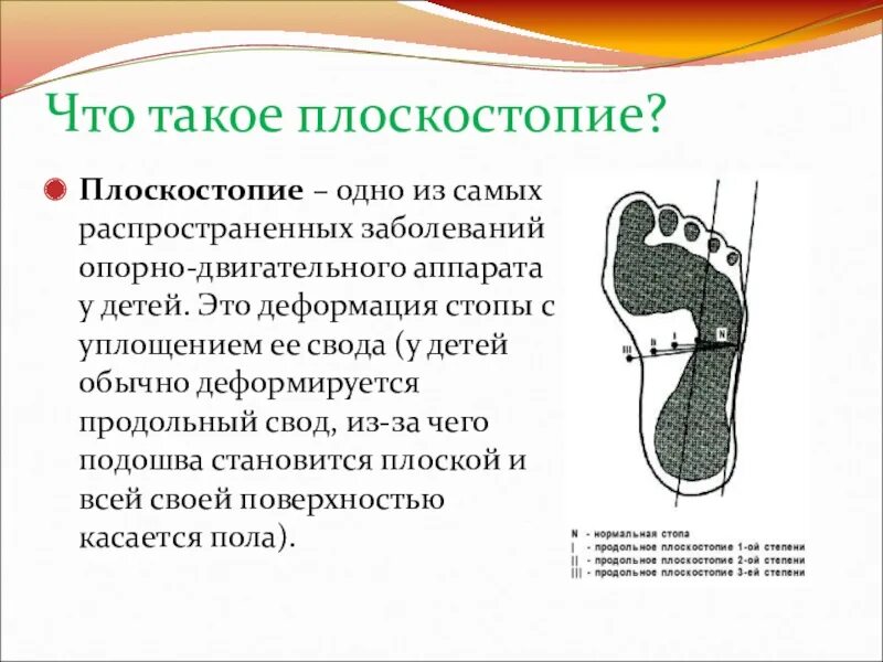 Как исправить плоскостопие у ребенка. Как бороться с плоскостопием.