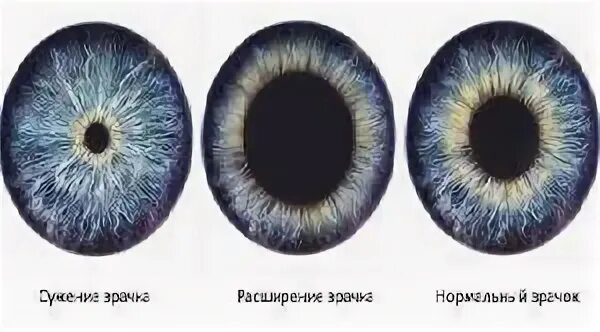 Как быстро сузить зрачки. Расширенный зрачок после капель. капли сужающие зрачки. глазные капли сужающие зрачок.