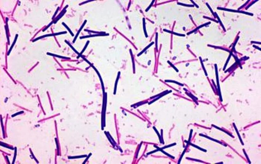 Микроскопия клостридиум диффициле. Clostridium botulinum микроскопия. Клостридия диффициле микробиология.
