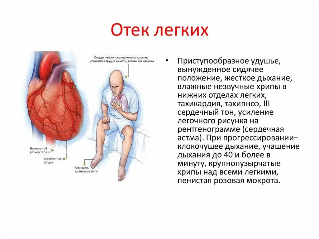 Отек легких положение больного. Отёк лёгкого при болезни сердца причины смерти. Положение пациента при отёке лёгких. Тип дыхания при отеке легких. Положение больного при отеке легких.