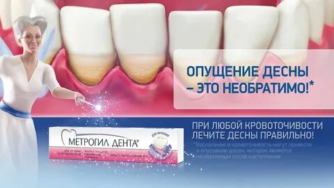 Народный лечение десен