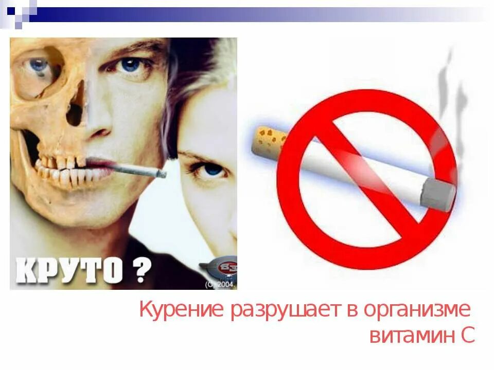 Клиническое проявление цинги. Цинга недостаток витамина. Проект на тему почему люди болеют цингой. Цинга развивается при недостатке витамина. Почему люди болеют.