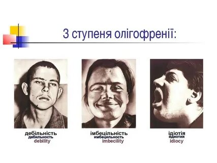 Олигофрения стадии