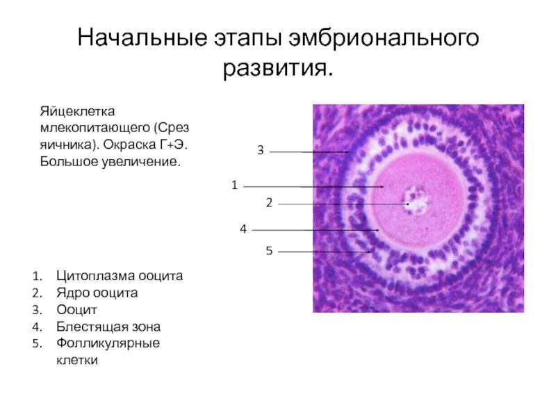 Увеличение больших половых. Яичник млекопитающего препарат гистология. Поперечный срез яичника гистология. Строение яйцеклетки млекопитающего. Схема строения яйцеклетки гистология.