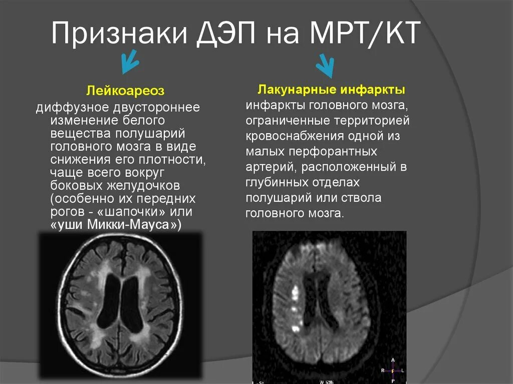 Умеренные атрофические изменения