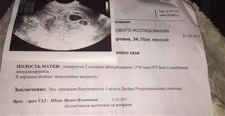 Срок 6 недель форум. Неразвивающаяся беременность 7 недель УЗИ. Трансабдоминальное УЗИ беременности на ранних сроках. Замершая беременность УЗИ. Ультразвуковое исследование беременности УЗИ.