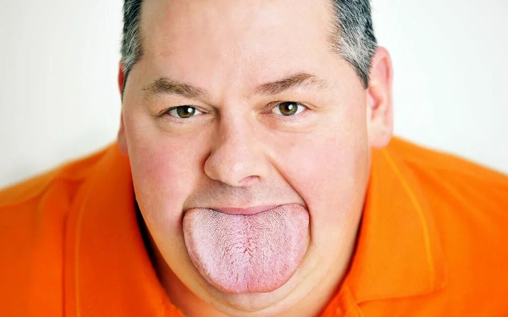 Несколько подбородков. Второй подбородок. Несколько подбородков. Второй подбородок. Несколько подбородков.