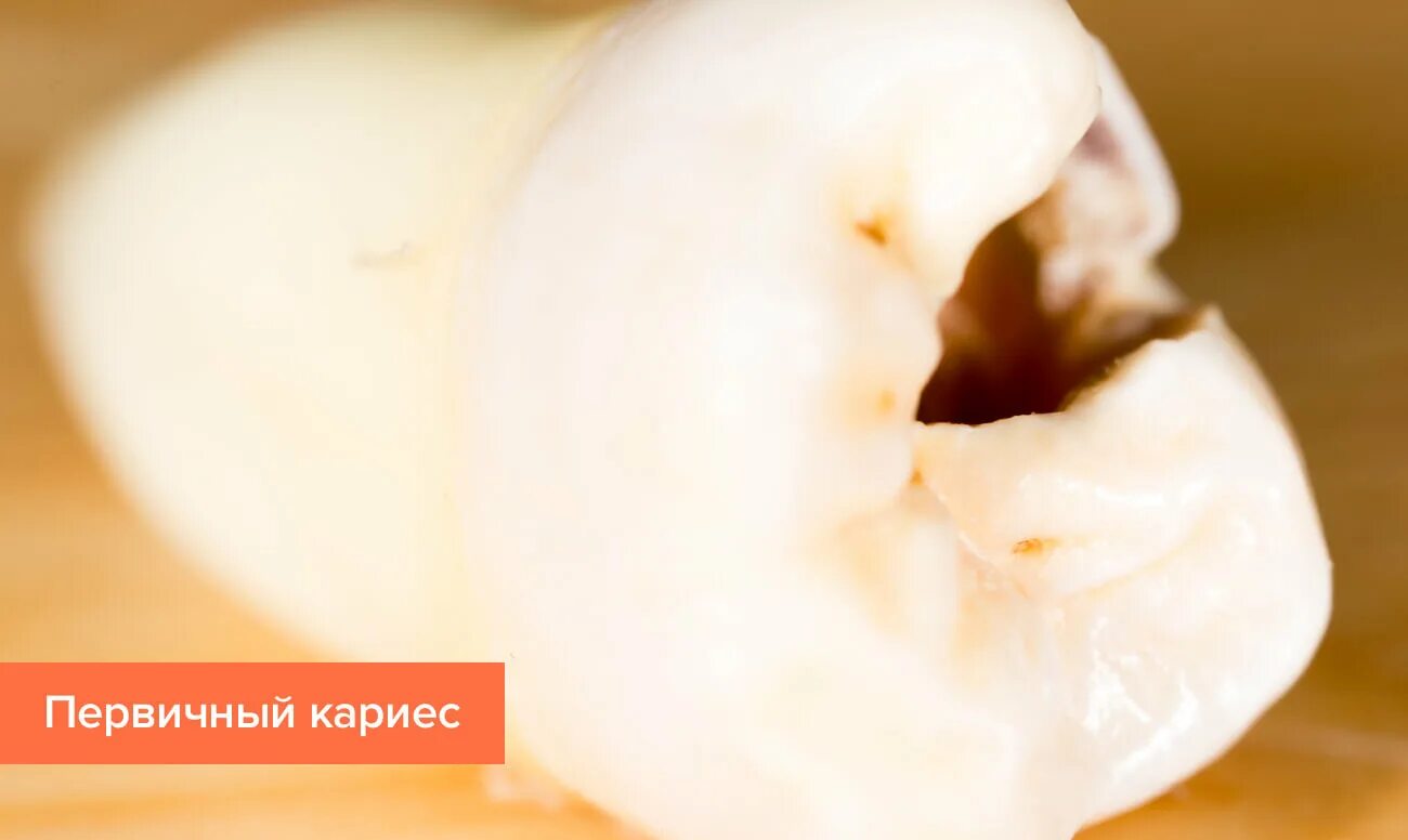 Веселый зуб. Зубы мультяшные. Зубы мультяшные. Веселый зуб. Зуб рисунок.