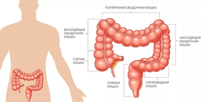 Опухоль печеночного изгиба ободочной кишки. Отделы Толстого кишечника ободочная кишка. Опухоль печёночного изгиба Толстого кишечника. Опухоль поперечно-ободочной кишки. Изгиб кишечника