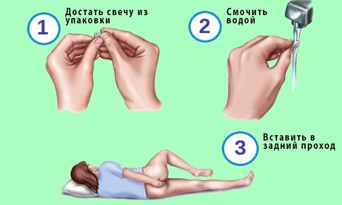 Схема введения ректальных свечей. Ректальное Введение лекарственных средств детям. Правильное Введение свечей ректально.