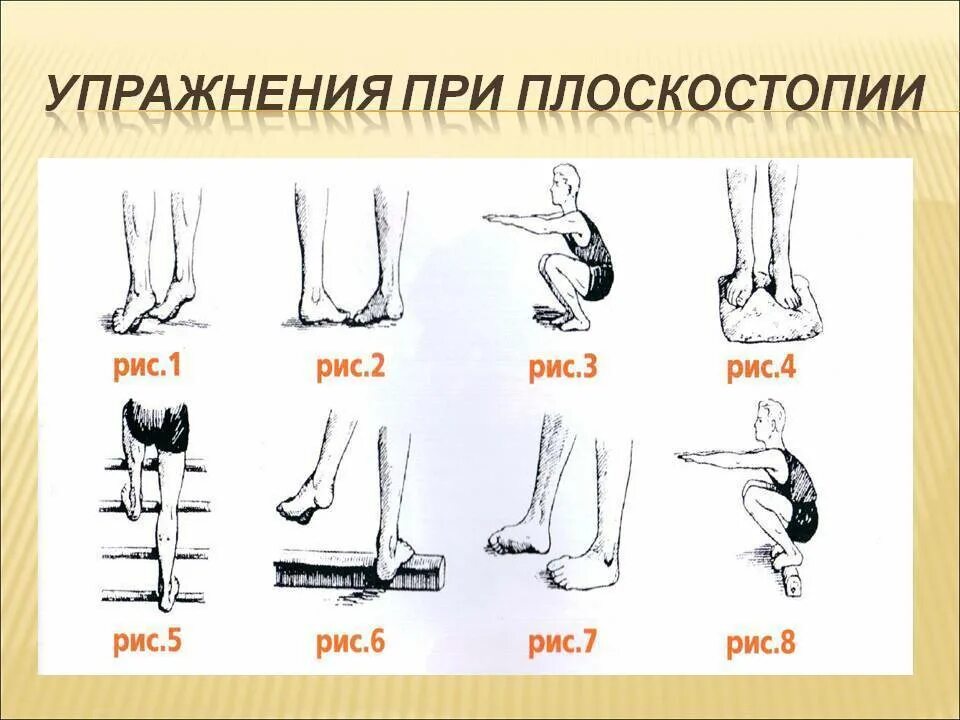 Упражнения лфк ног. ЛФК при вальгусной деформации стопы у детей 3 года. Упражнения при вальгусе стоп у детей 2. Массаж при вальгусной деформации стопы у детей 4 года. Упражнения при вальгусной деформации стопы у детей 8 лет.