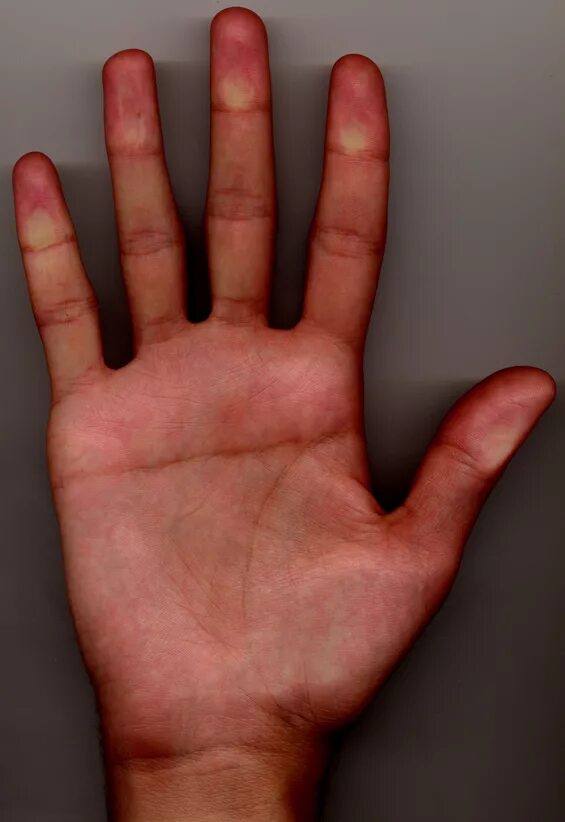 обезьянья линия