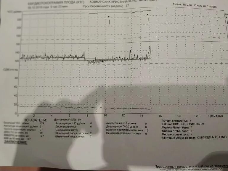 КТГ плода норма 36 неделе беременности. КТГ норма 37-38 недель норма. КТГ плода 38 неделе беременности. Нормальное КТГ плода на 36 неделе. 38 неделя мало шевелится