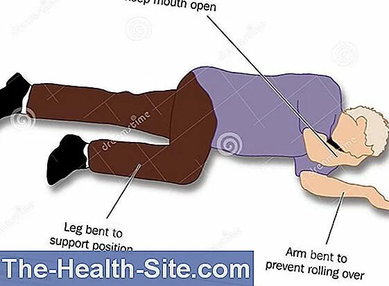 Lateral position. Lateral coital position. Lateral stability. Positions for first Aid. First position