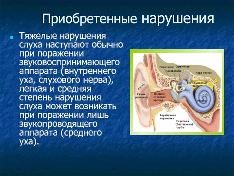 Поражение слухового нерва. Звуковоспринимающий аппарат слухового анализатора. Звукопроводящий аппарат: среднее ухо.. Нарушение звуковоспринимающего аппарата. Звукопроводящая система уха.