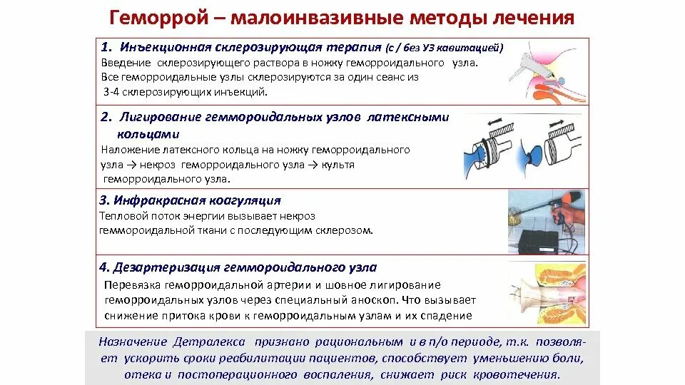 Малоинвазивные методы лечения геморроя. Малоинвазивная методика при геморрое. Алгоритм лечения геморроя. Дезартеризация геморроидальных узлов методика. Малоинвазивное лечение геморроя