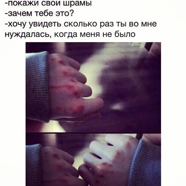 Стали шрамами на теле текст