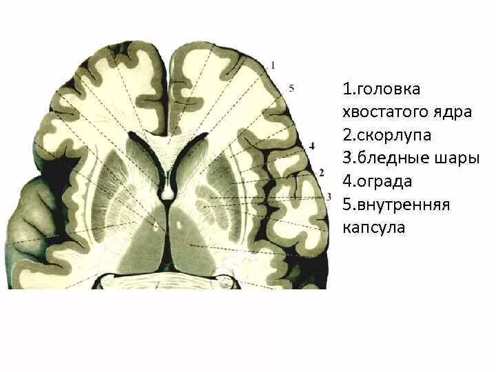 Хвостатое ядро мозга. Головка хвостатого ядра. Головка хвостатого ядра анатомия. Головка хвостатого ядра головного мозга. Внутренняя капсула хвостатого ядра.