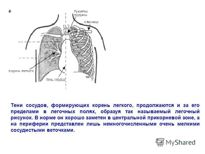 Сосуды корня расположены