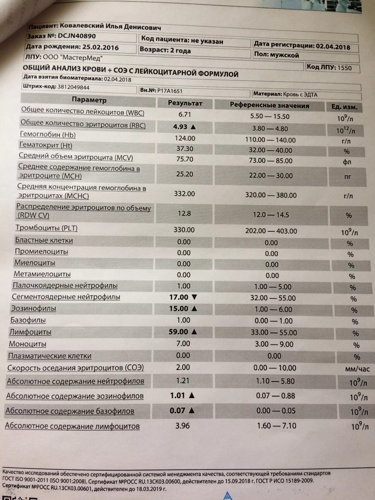 Результат анализа коклюш. Анализы при коклюше. Анализ крови при коклюше. Общий анализ крови при коклюше у детей. ОАК при коклюше у детей.