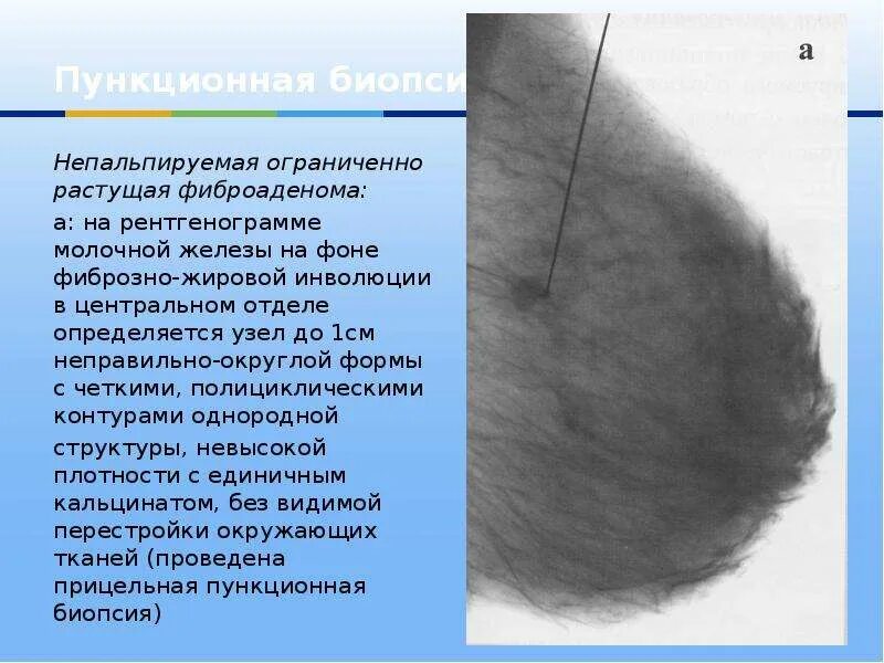 Уплотнение без четких контуров